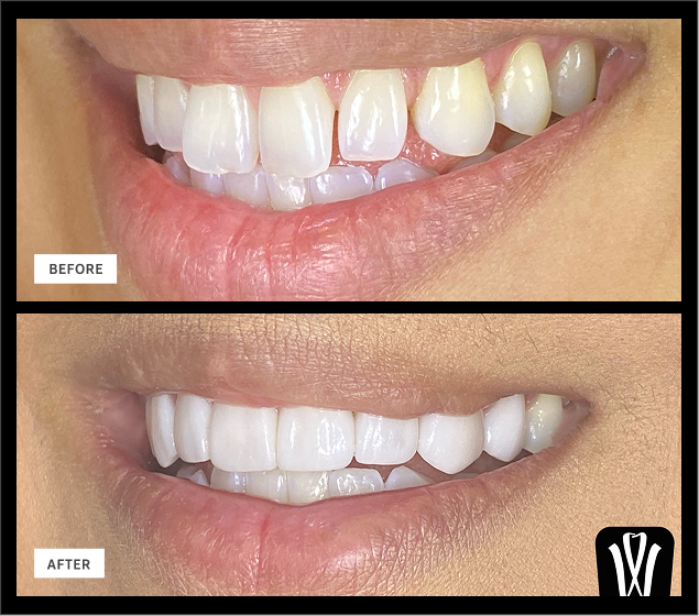 Smile Gallery | Woodlands Family Dental
